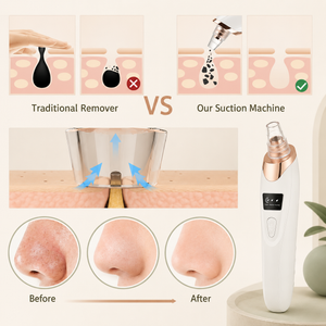 5-in-1 Rechargeable Electric Blackhead Remover