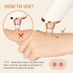 5-in-1 Rechargeable Electric Blackhead Remover